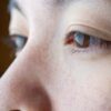 Thumbnail of related posts 044